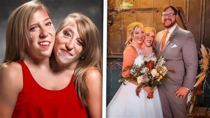 Are Abby And Brittany Hensel Married? All You Need To Know
