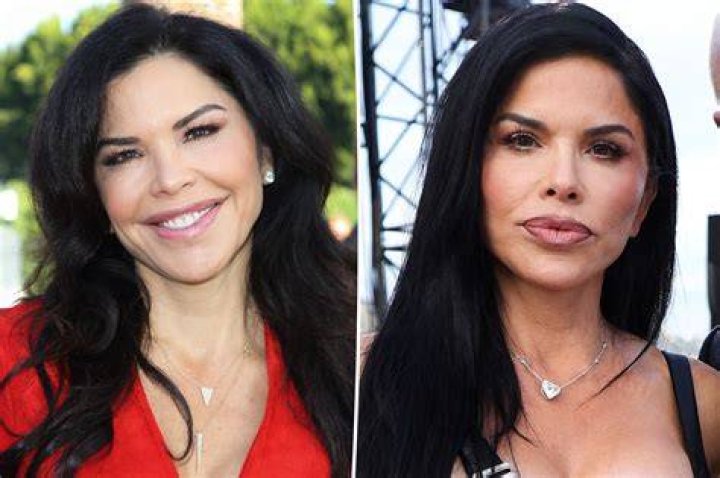 Before And After Of Janaina Prazeres Plastic Surgery