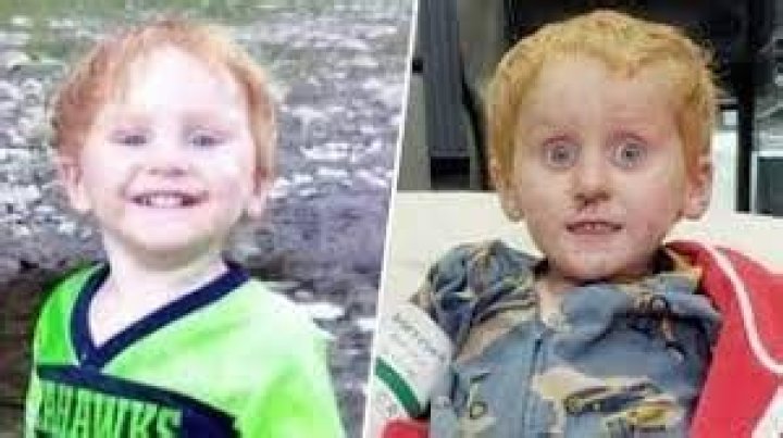 Before And After of Ryker Webb