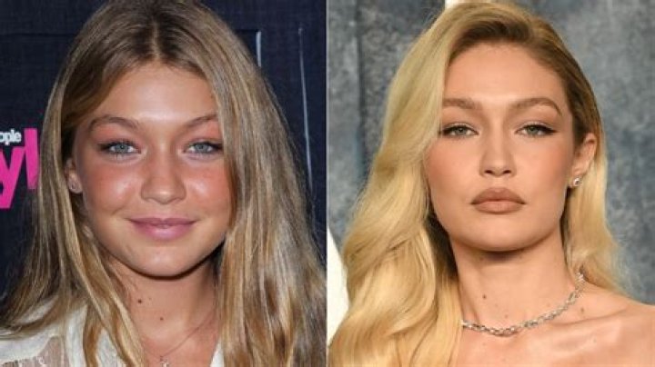 Did Gigi Hadid Get Plastic Surgery?