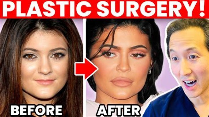 Has Omid Scobie Had Plastic Surgery? Who is Omid Scobie?