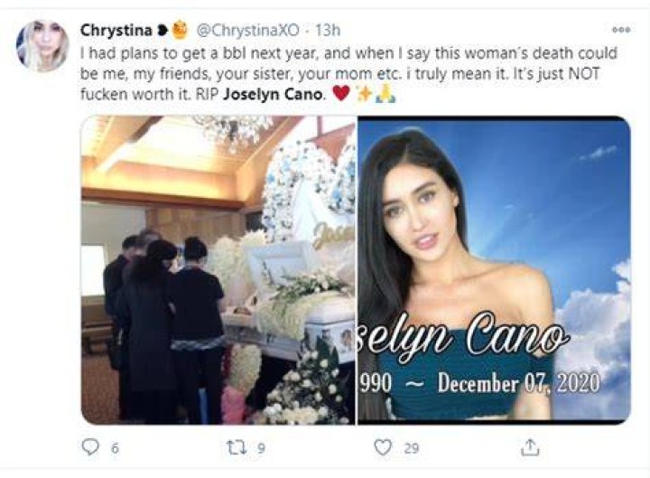 Instagram Slay Queen, Joselyn Cano Dies During Plastic Surgery (Photos)