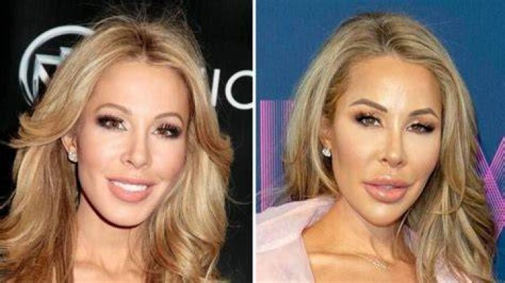Lisa Hochstein Before And After