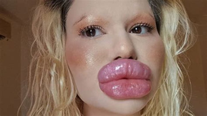 Meet Demilade, The Lady With The Biggest & Captivating Natural Lips In Nigeria