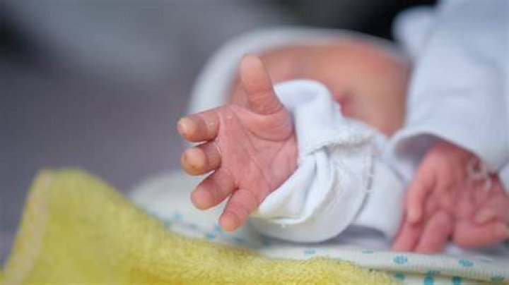 Meet The Baby Born With Four Eyes And Two Faces That Her Family Sees As ‘god’ (VIDEO)