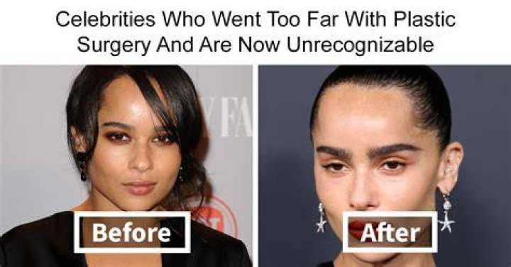 Mzansi Celebs Who Have Undergone Cosmetic Surgery