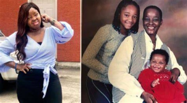 Plane Crash Survivor, Kechi Okwuchi Shares Some Before And After Photos With Her Mother & Sister