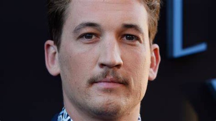 This is how Top Gun star Miles Teller’s facial scars came about.