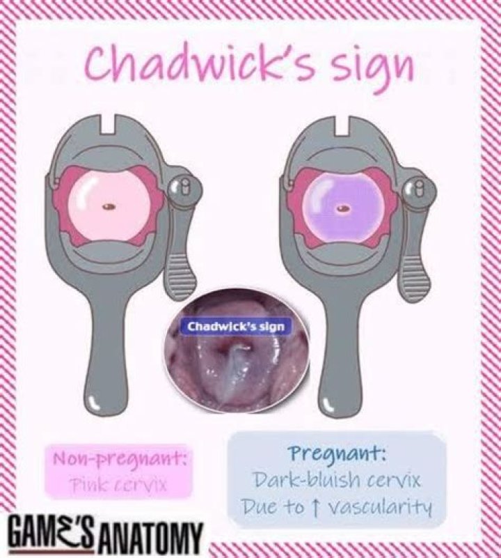 What Is Chadwick Tromp’s Net Worth?
