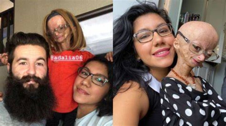 Who is Adalia Rose's Biological Father?