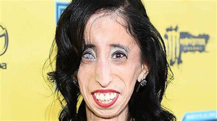 Who Is The Ugliest Person In the World? Pictures And List